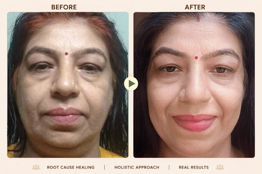 I Thought My Skin Problem Was Just on My Face. I Was Wrong. - Trehi Organics