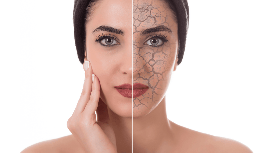 Nourishing Dry Skin: Oils for a Healthy Complexion - Trehi Organics