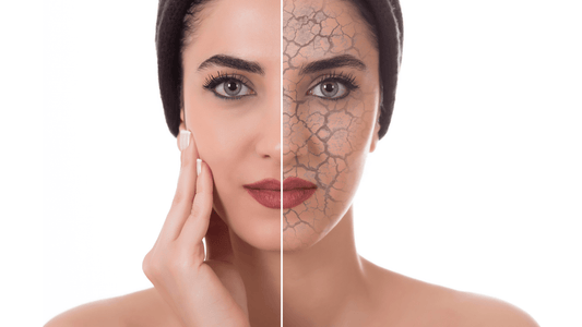 Nourishing Dry Skin: Oils for a Healthy Complexion - Trehi Organics