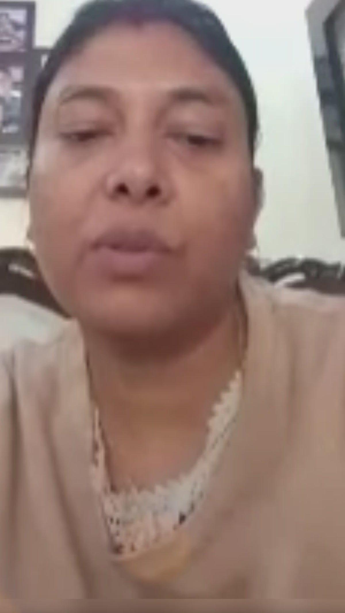 Jyoti - Pimples & Acne